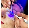 UV-System-Set - Lampe, Kleber und Brille zum günstigen Preis